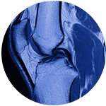mri-scan mri-scan